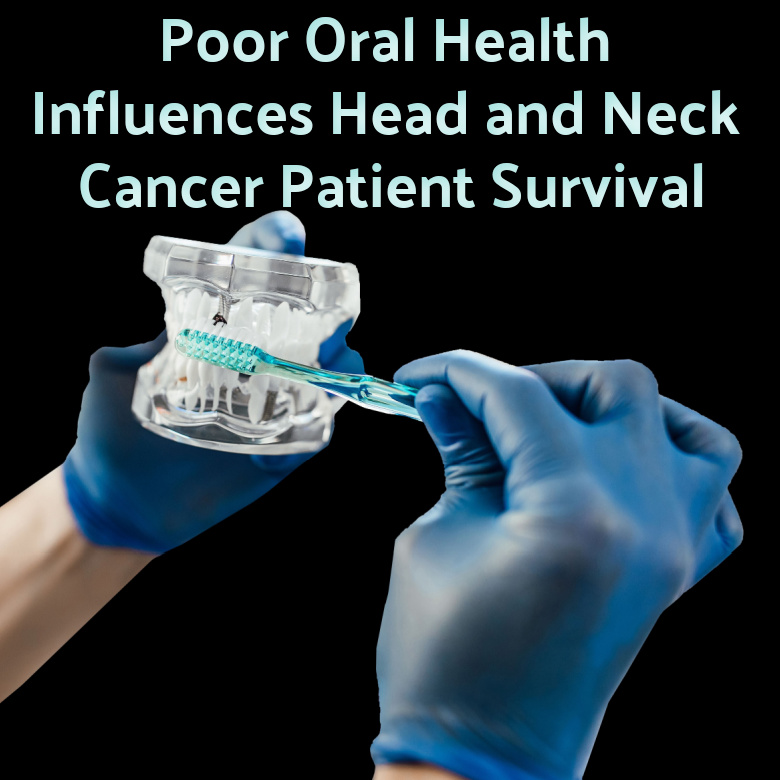 Poor Oral Health Influences Head and Neck Cancer Patient Survival: An International Head and Neck Cancer Epidemiology Consortium Pooled Analysis
