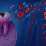 If We Treated Tooth Decay Like We Treat Heart Disease, We’d Save Billions